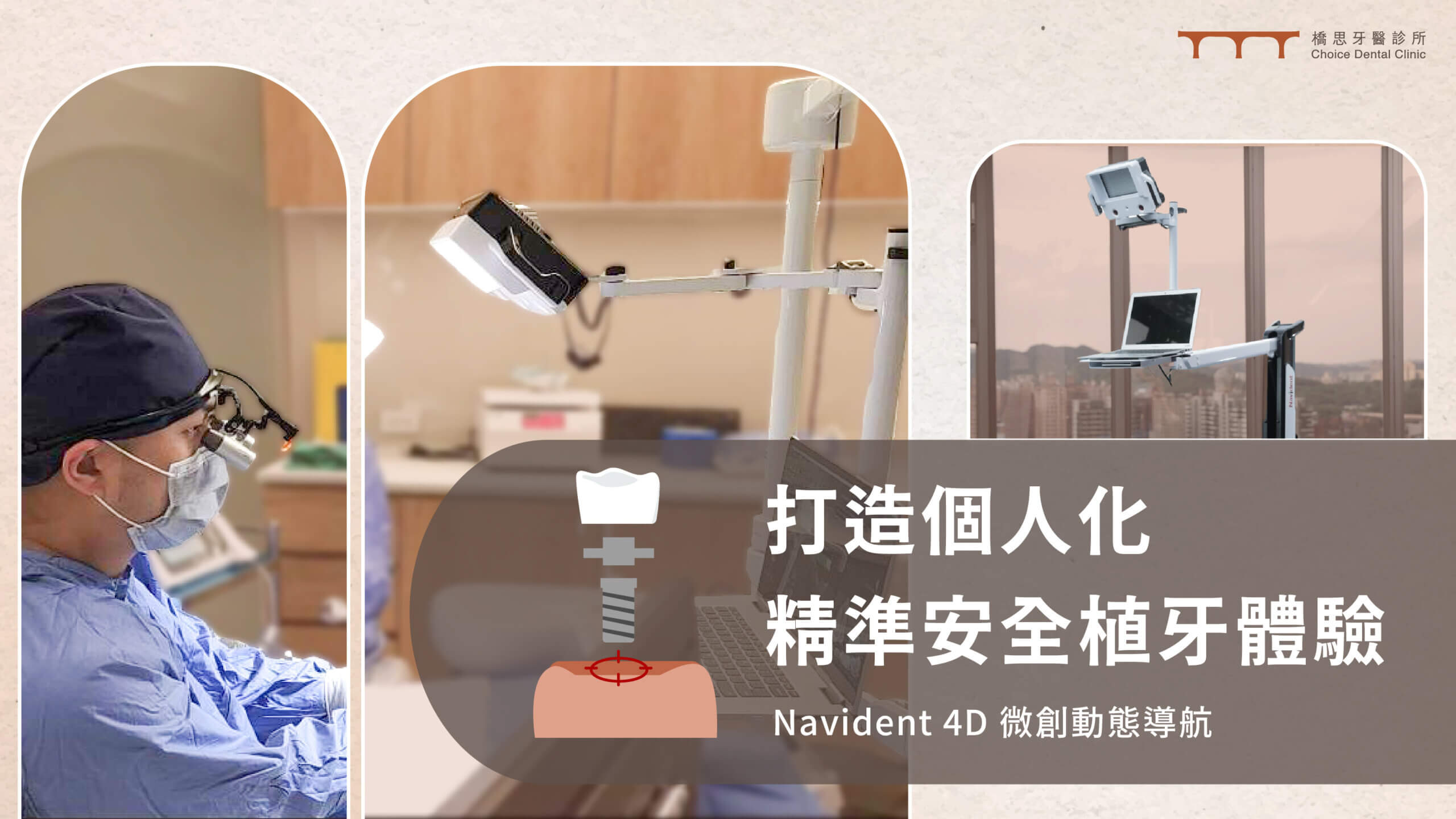 Implant with Navigation System Choice Dental Clinic